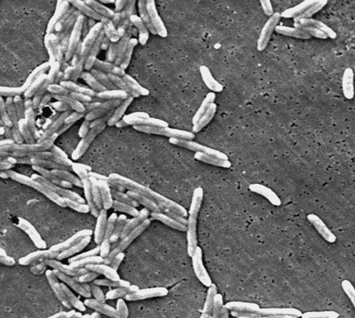 Campylobacter fetus bacteria. Image credit: CDC. Obtained via Wikimedia Commons. Click for more information.