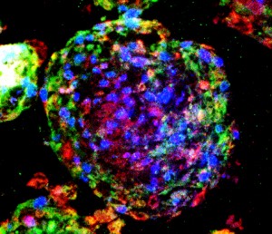 Lung stem cells (green and red) residing in a cultured lung spheroid. 