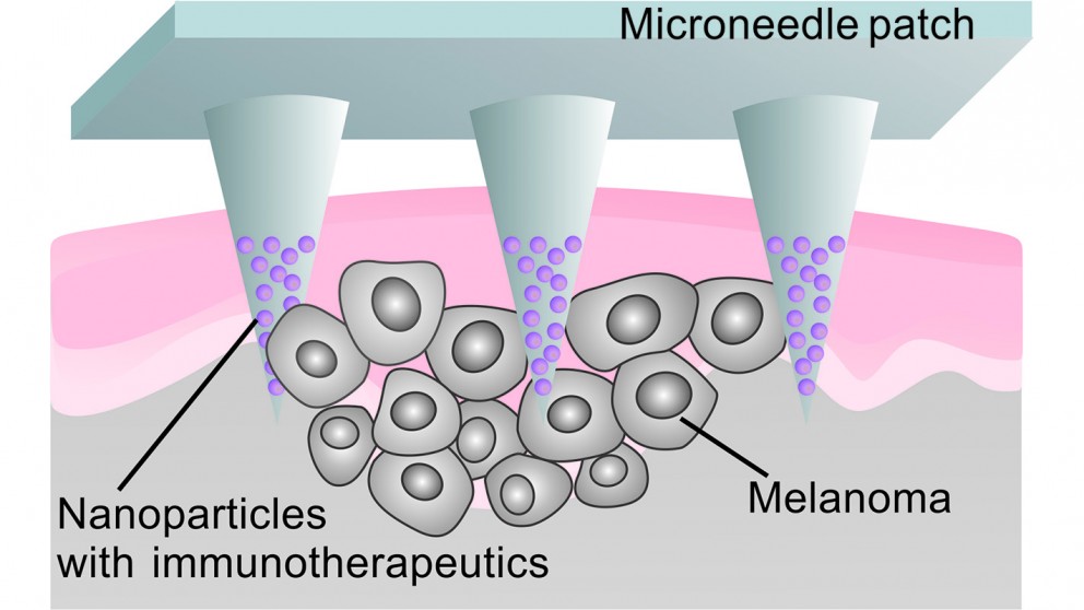 Enhanced Cancer Immunotherapy by Microneedle Patch-Assisted Delivery of Anti-PD1 Antibody.