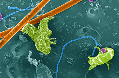 Scanning electron micrograph of home dust including dust mites, animal fur, fibers, and pollen. Image credit: Anne A. Madden, with the assistance from Robert Mcgugan at the University of Colorado, Boulder Nanomaterials Characterization Facility. False-coloring done by Robin Hacker-Cary. Click to enlarge.