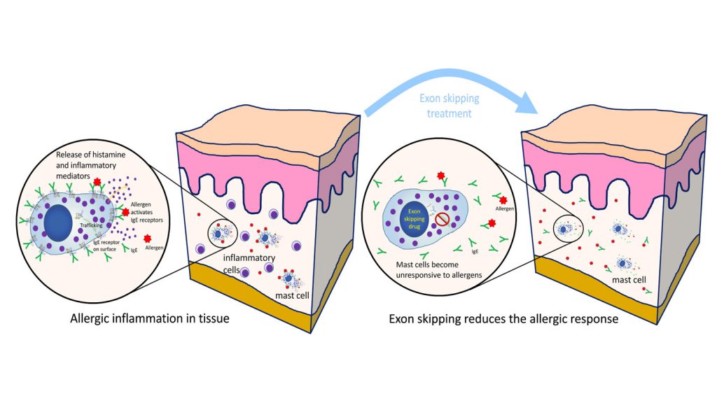 New Treatment for Allergic Response Targets Mast Cells | NC State News