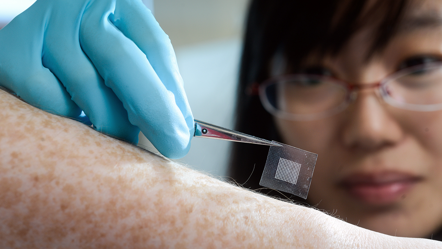 A researcher applies an insulin patch to a freckled forearm.