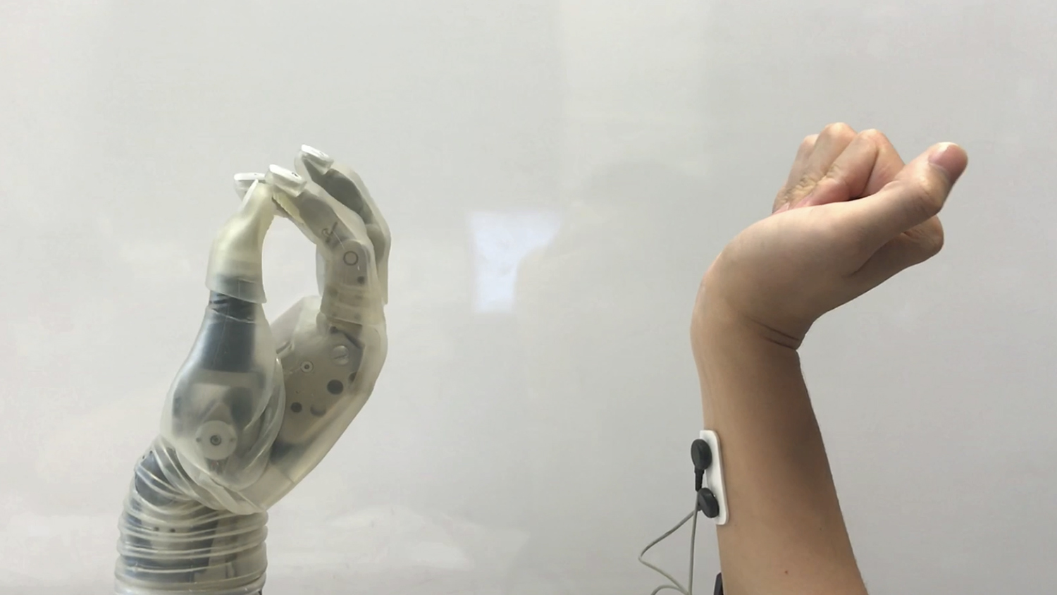 Prosthetic hand mimics real hand movement