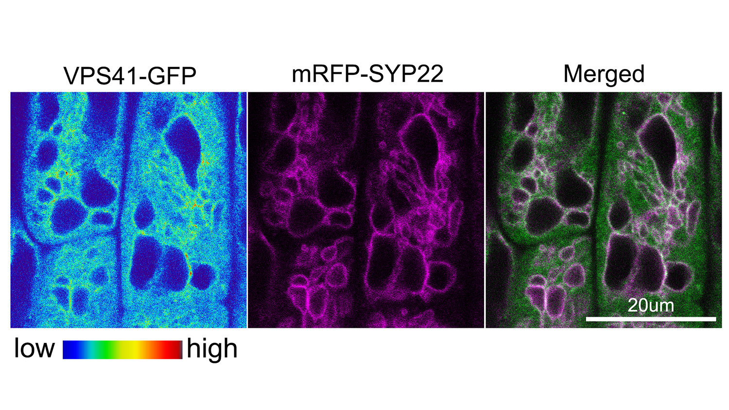 Microscopy image of vacuole fusion in plants.