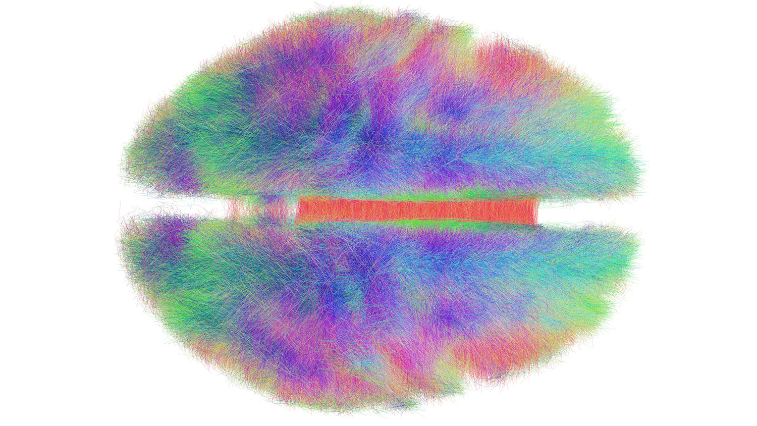colorful schematic of connections in the brain