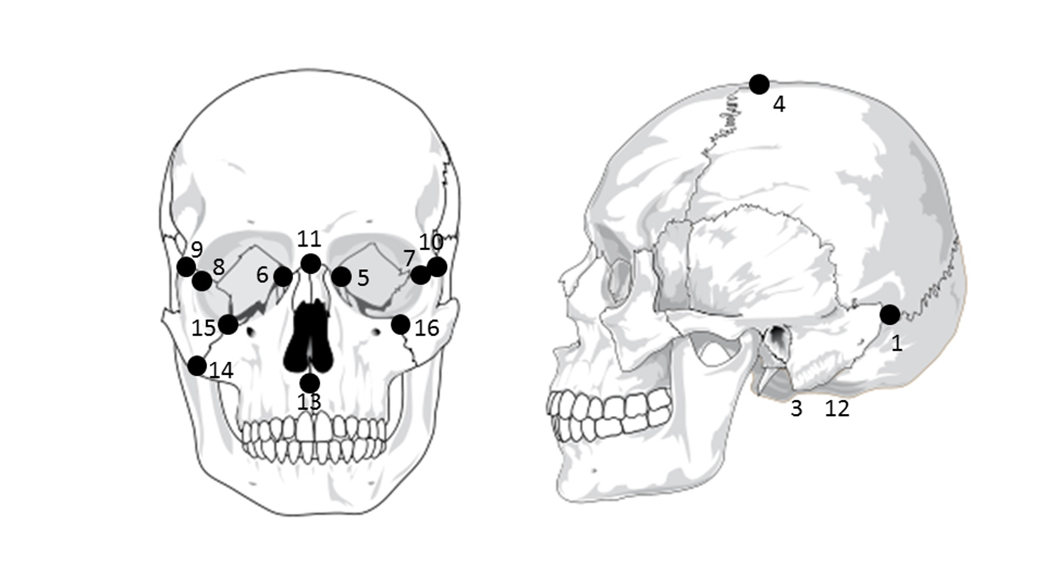 Common craniofacial landmarks.