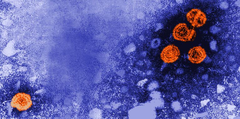 how-long-can-viruses-survive-in-a-dead-body-nc-state-news