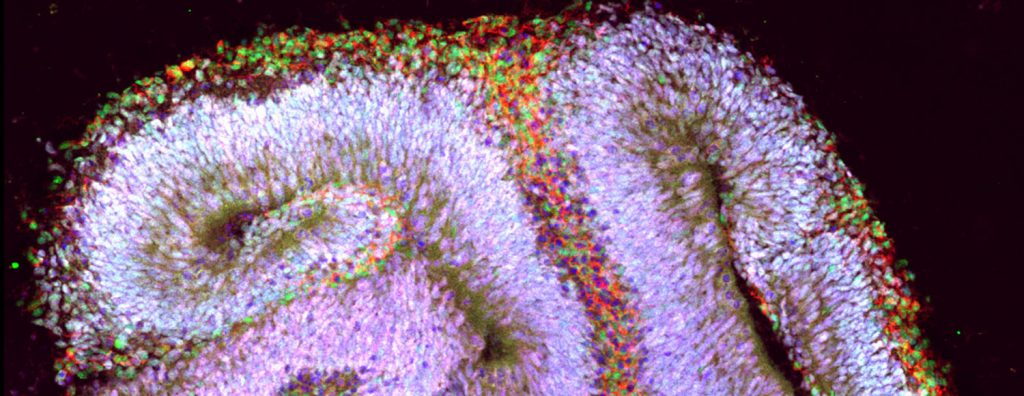 The purple and green specks that make up the organoid curl over a black background