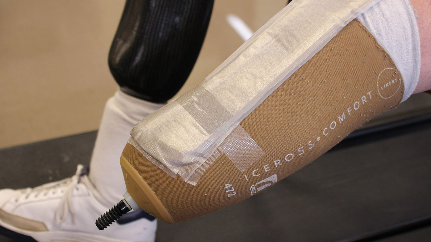 Textile sensor can detect pressure points on the socket of a prosthetic limb.