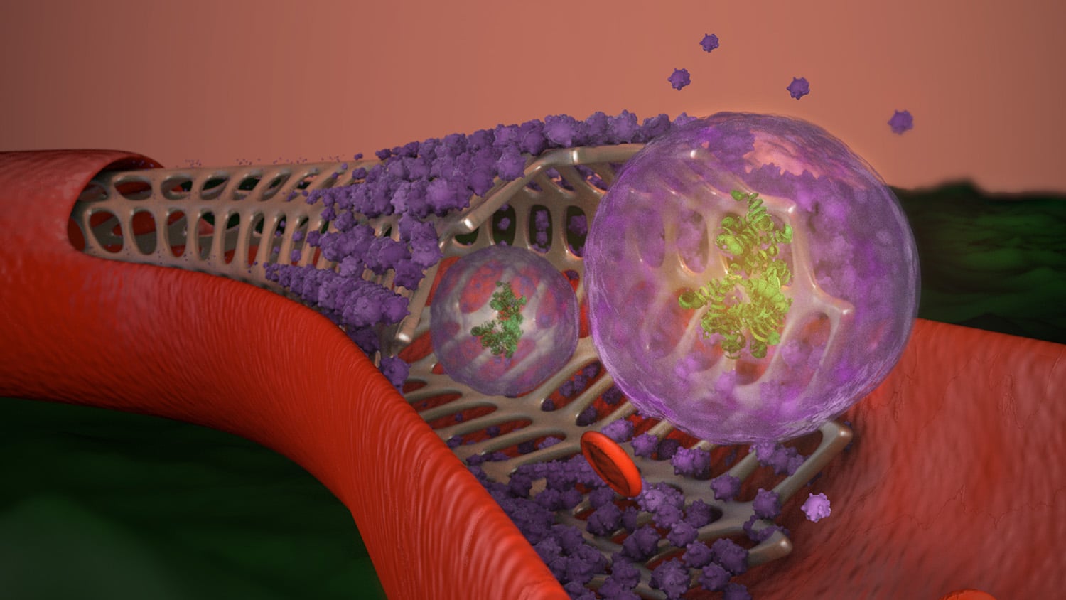 stent in blood vessel