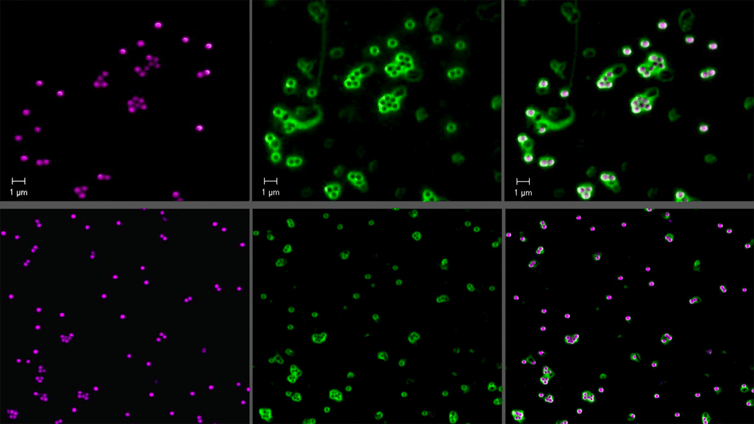 Green and purple microscopic imaging shows particles coated in DendriPeps separate while shear increases.