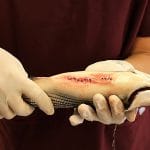 Student holds a fish with sutures visible along its underside.
