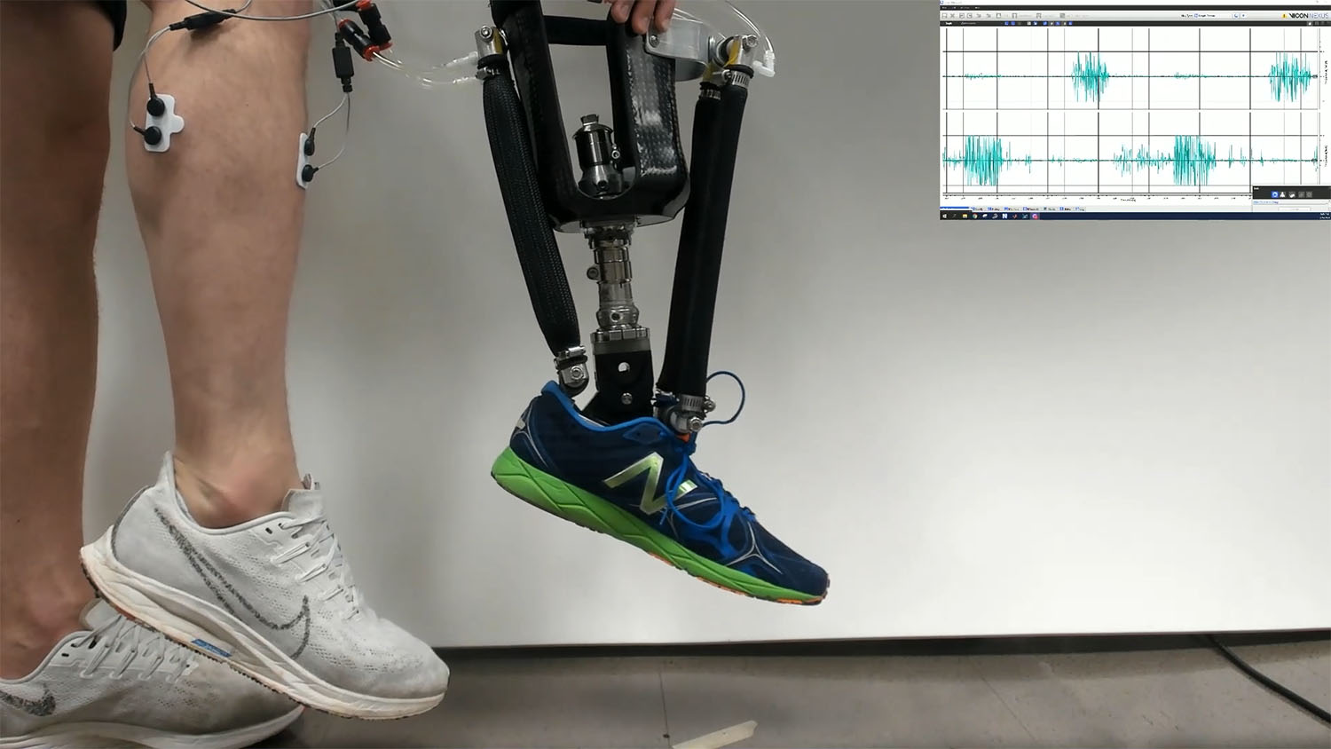 Robotic Prosthetic Ankles Improve ‘Natural’ Movement, Stability | NC ...