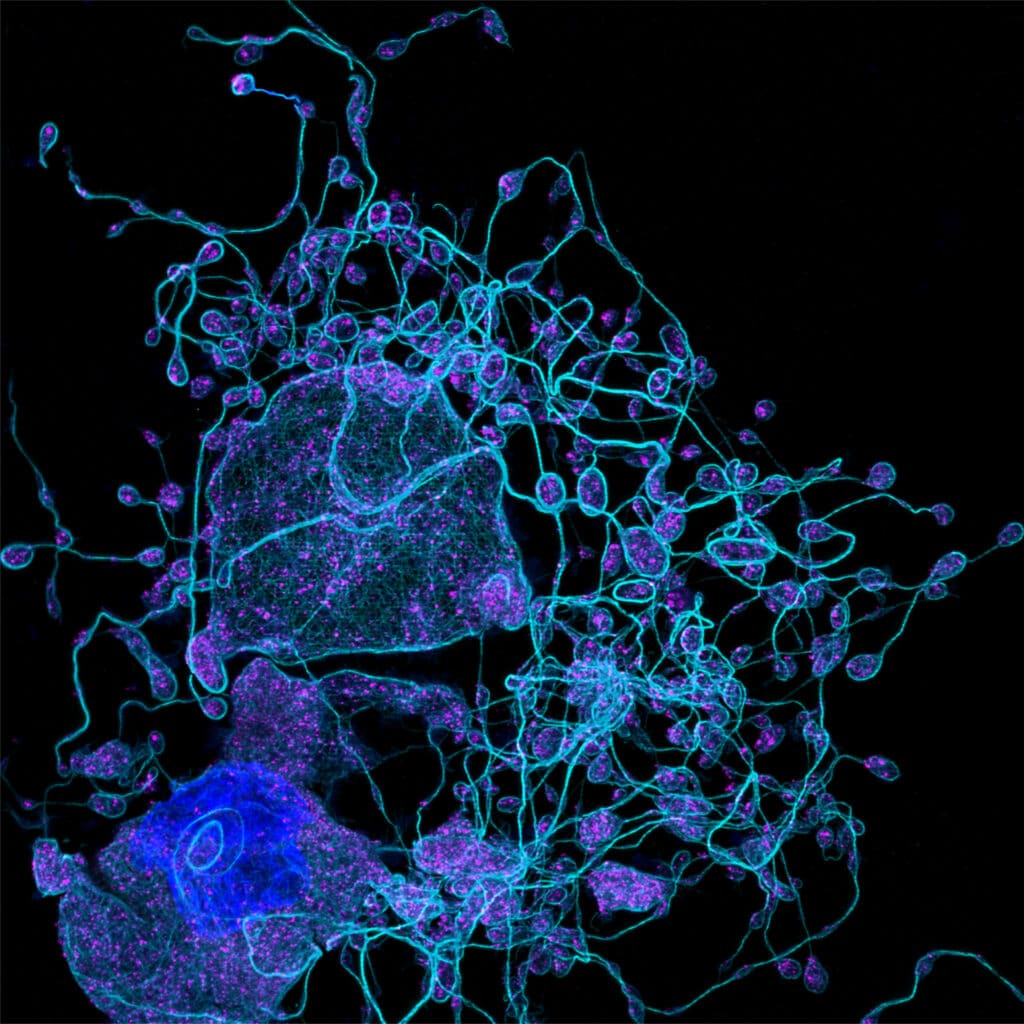 A microscopy image of a network of light blue lines and circular regions of pink and green showing showing platelets as they are generated from cells called megakaryocytes that reside within the bone marrow.